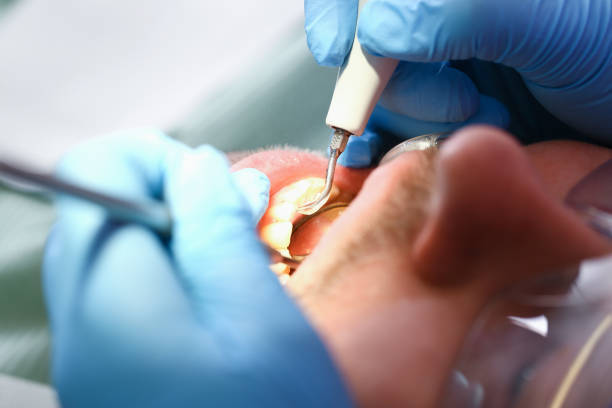 Best Broken Tooth Emergency  in Wayland, IA
