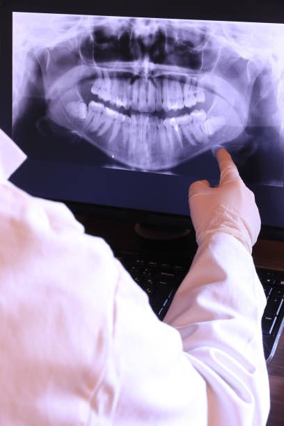 Best Root Canal Emergency Dentist  in Wayland, IA